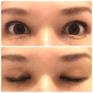 27 days after image