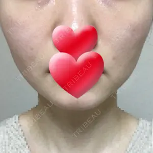 28 days after image