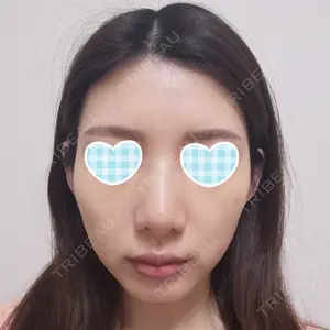 12 days after image