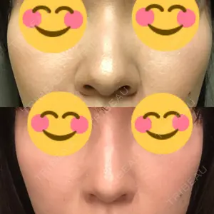34 days after image