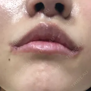 27 days after image