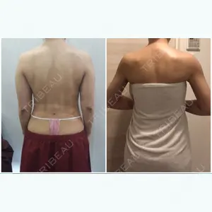 56 days after image
