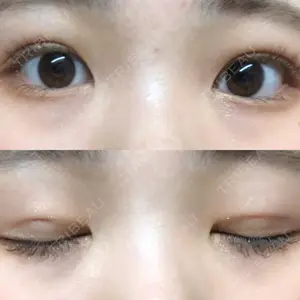 47 days after image