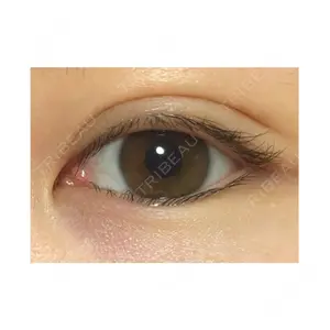 38 days after image