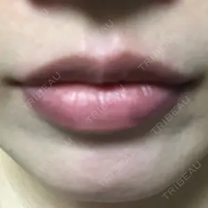 30 days after image