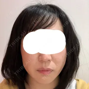 182 days after image