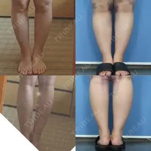 29 days after image