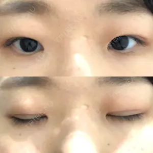 28 days after image