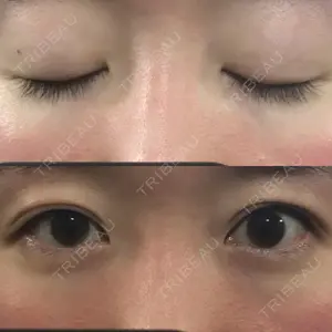 677 days after image