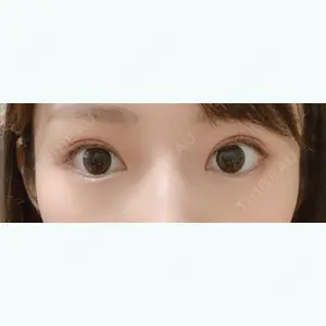6 days after image