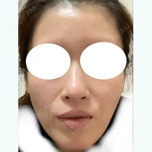308 days after image