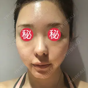 254 days after image