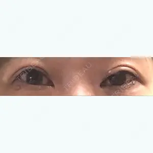 口コミ