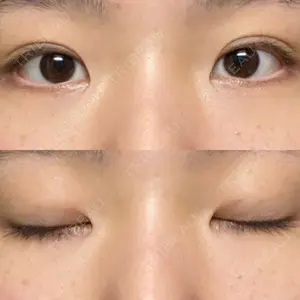 55 days after image