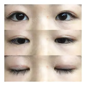 74 days after image