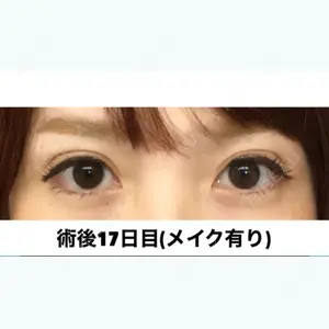 口コミ