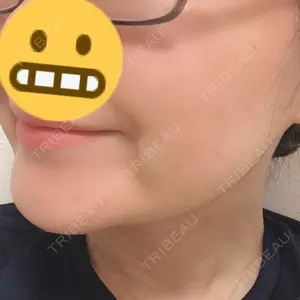 30 days after image