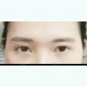 44 days after image
