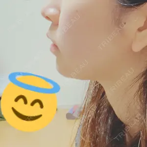 4 days after image