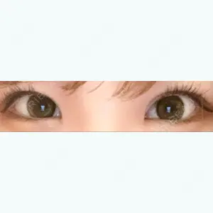 72 days after image