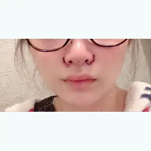 1 days after image
