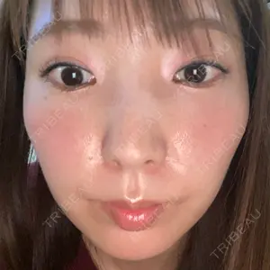 4 days after image