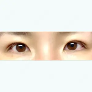 55 days after image