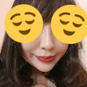 90 days after image