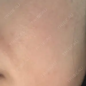 40 days after image