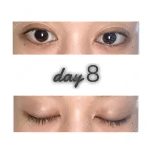 8 days after image