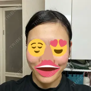 92 days after image