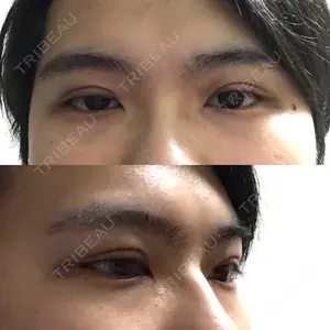 0 days after image