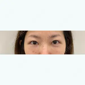 37 days after image