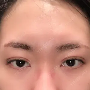 1 days after image