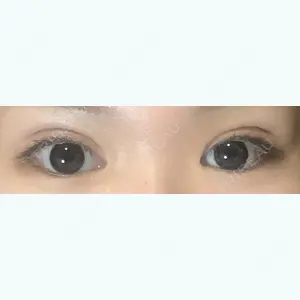 34 days after image