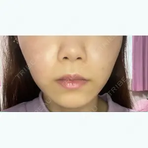7 days after image