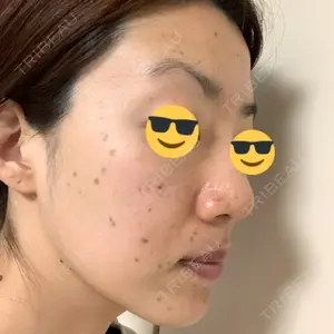 4 days after image