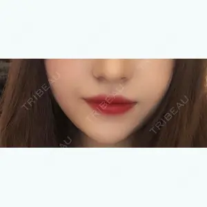 TCB東京中央美容外科 TCB東京中央美容外科 堺院口コミ