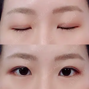 139 days after image