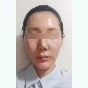 32 days after image