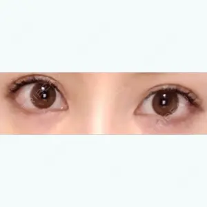 7 days after image