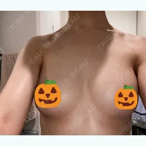 74 days after image
