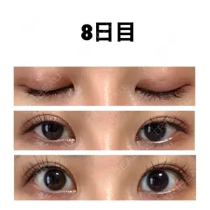 8 days after image