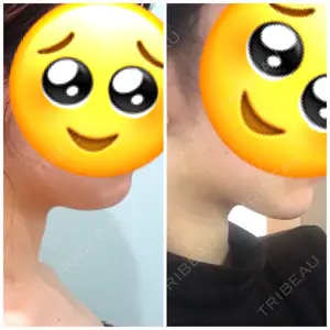 1 days after image