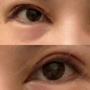 4 days after image