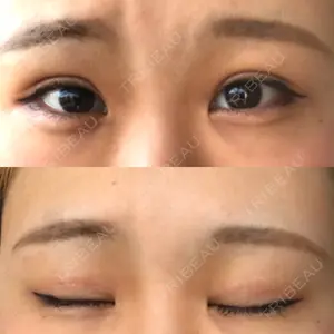 16 days after image