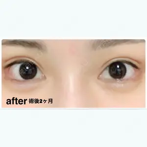 61 days after image