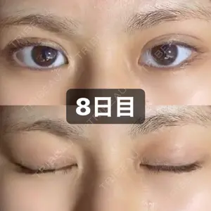 8 days after image