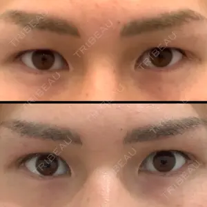 35 days after image
