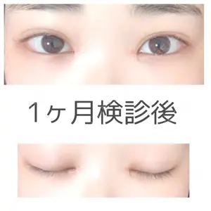 36 days after image